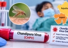 Centre Deploys Expert Team as Chandipura Virus Outbreak Spreads in Gujarat and Rajasthan